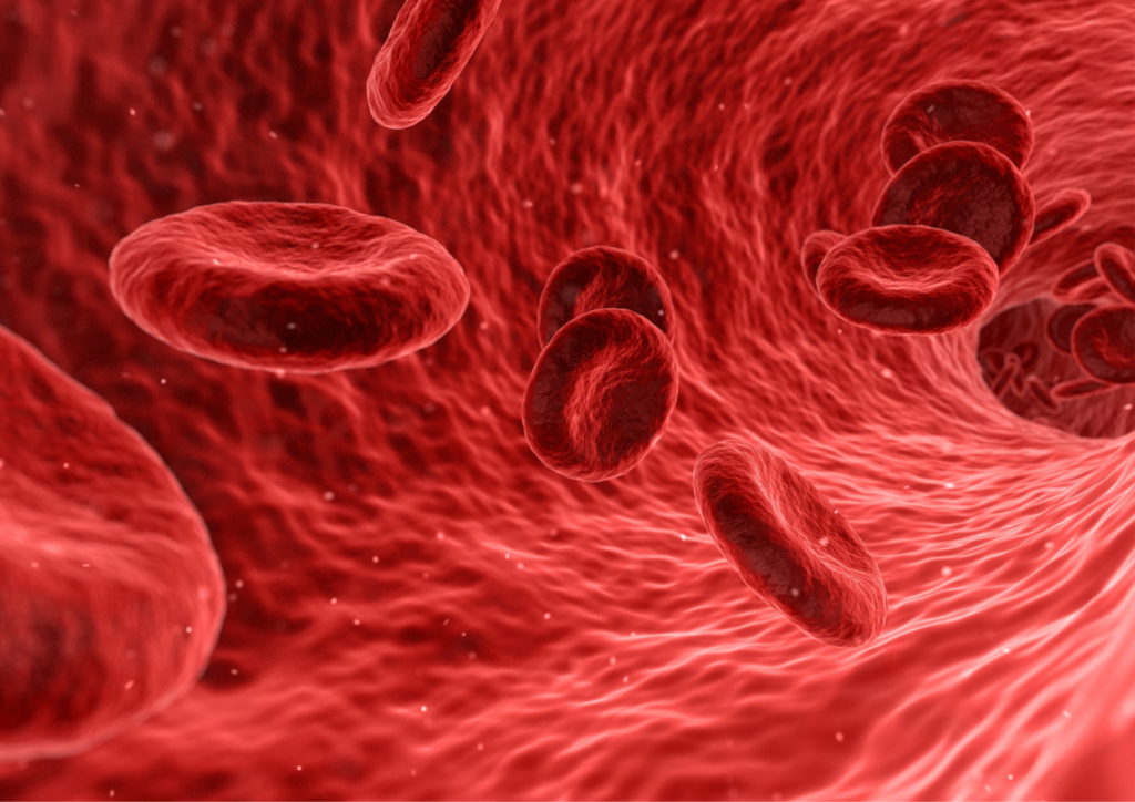 What is iron deficiency anaemia?