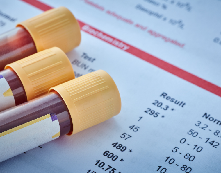 Your blood test results