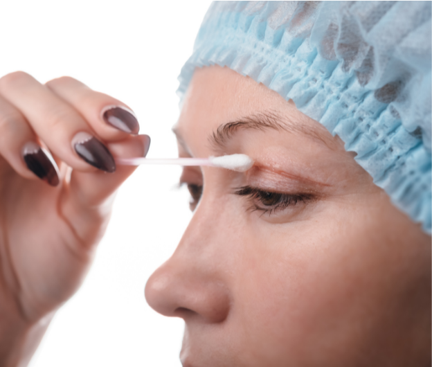What does blepharoplasty surgery involve?