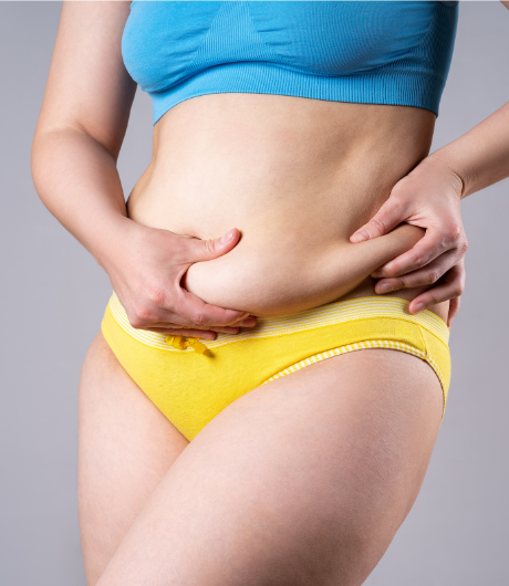 Who is a good candidate for a tummy tuck?