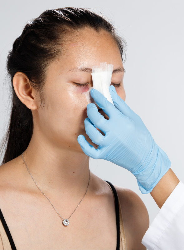 Is rhinoplasty surgery safe?