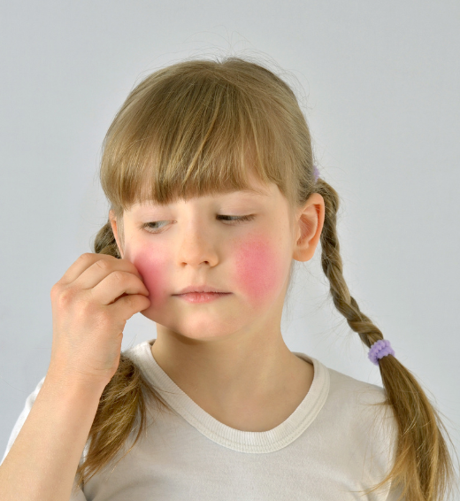 Dermatology services for children and teenagers