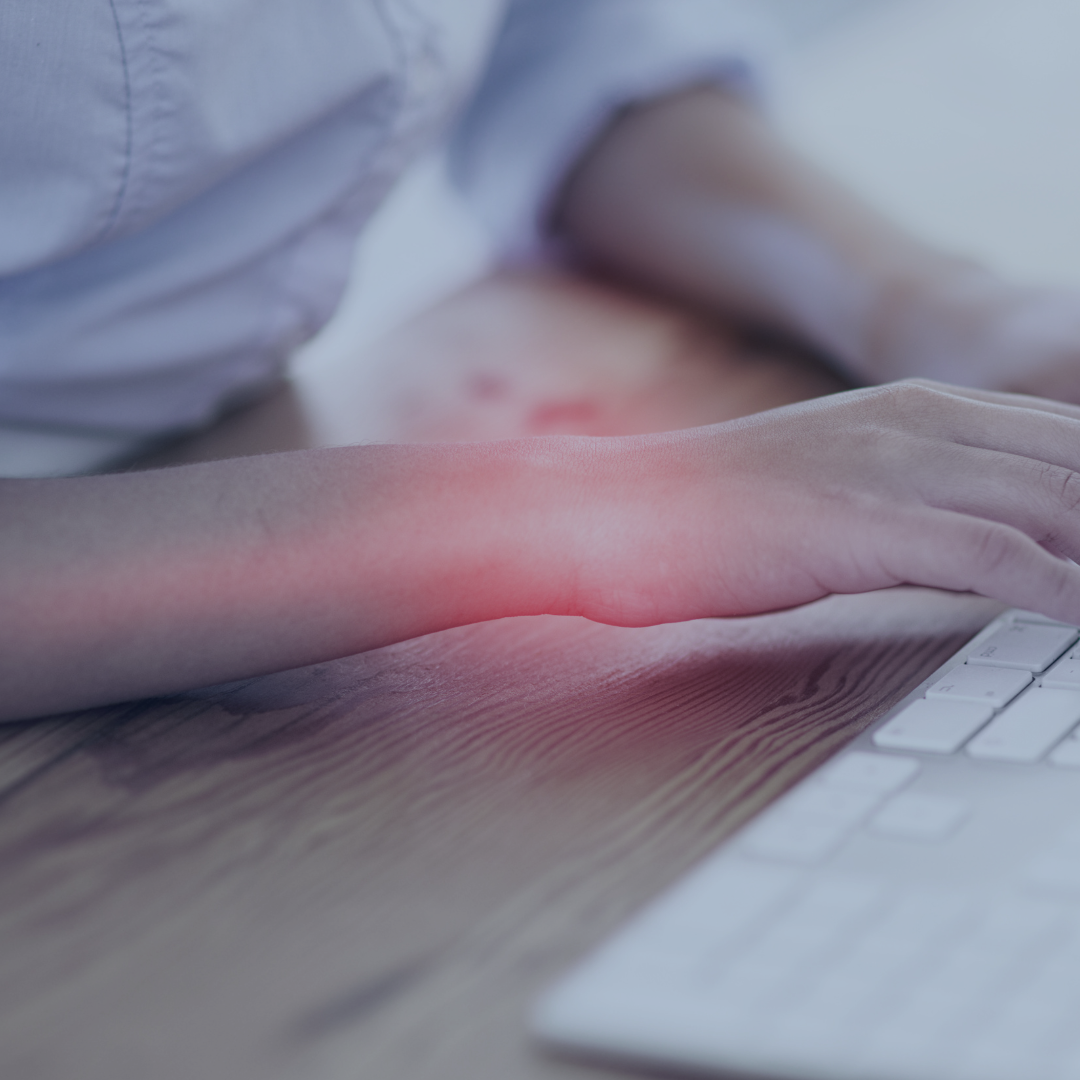 Symptoms of Carpal Tunnel Syndrome