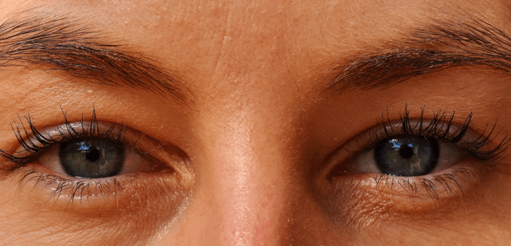 Lens Replacement Surgery Across Phoenix Hospital Group